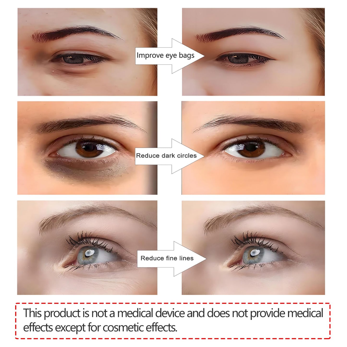 GlowLens™ Under-Eye Red Light Therapy
