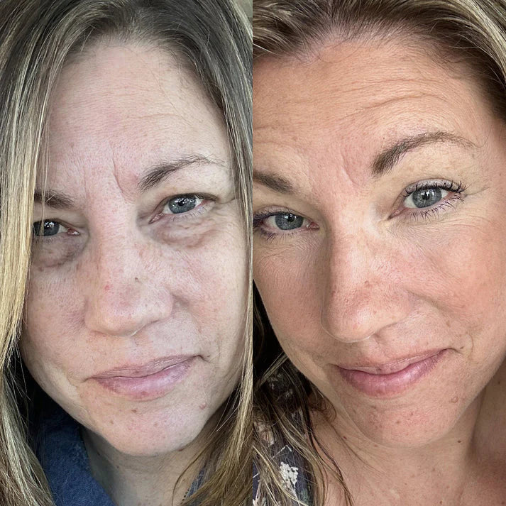 GlowLens™ Under-Eye Red Light Therapy
