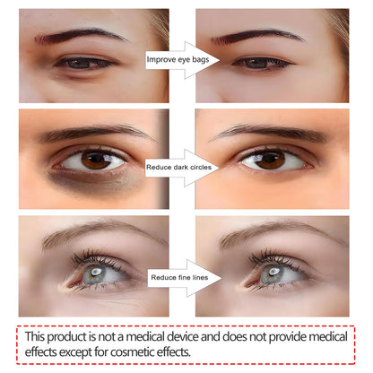 GlowLens™ Under-Eye Red Light Therapy